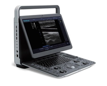 SonoScape - E1 Portable Ultrasound Scanner