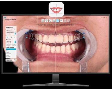 AlliedStar - TRUE WIRELESS INTRAORAL SCANNER AS200E