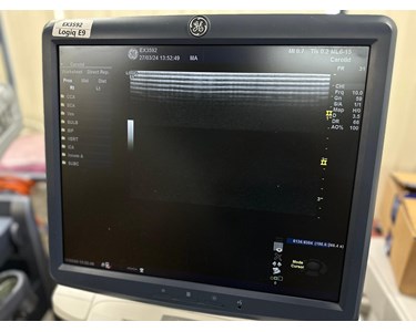 GE - Logiq E9 | Ultrasound Machine | EX3592