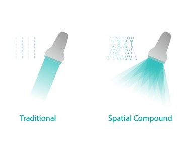 SonoScape - P10 Trolley Color Doppler Ultrasound System