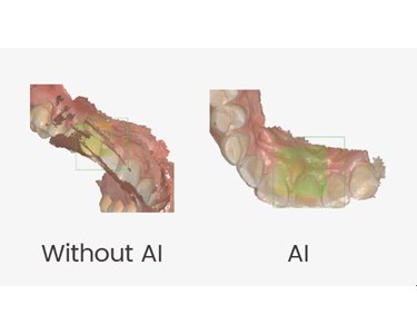 Aidite - Rapid 3 Intraoral Scanner