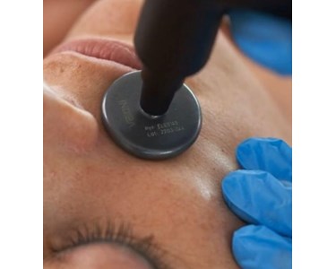 INDIBA - Elite NS - RF Device for Diverse Medical Aesthetic Applications