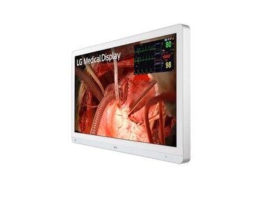 LG - Surgical Monitor | 27" 4k IPS | 27HQ710S-W​ | Medical Monitor