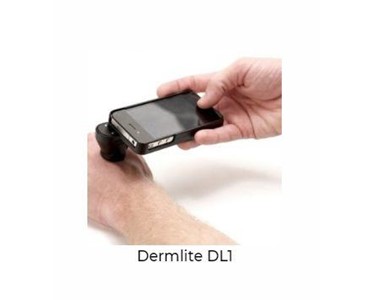 Dermlite - Dermatoscopes | DL1