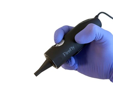 Firefly - 4K Digital Video Otoscope for ENT and Audiology