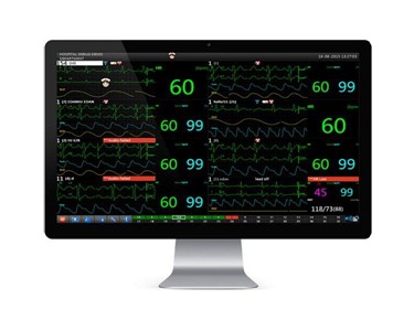 BMV - Vet Multi-parameter Patient Monitor | BMO-210