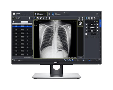 Vieworks DR detector