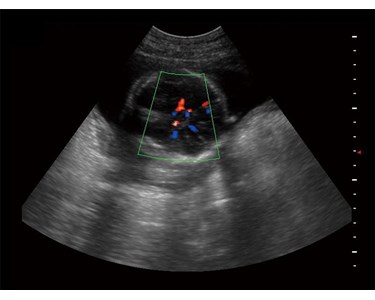 SonoScape - S9 Portable Color Doppler Ultrasound System