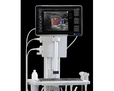 Terason - uSmart 3200T Plus Colour Doppler Ultrasound Machine