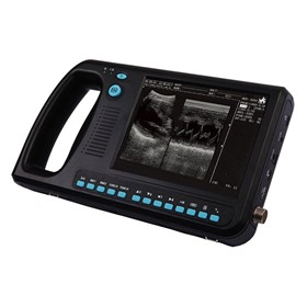 Portable Ultrasound Machine | WD-300