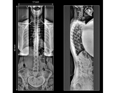 Full Spine Integrated Digital X-Ray Chiropractic Solution