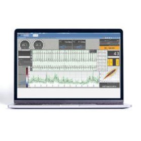 Electrocardiogram Analysis Medical Software