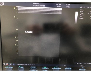 GE - 12L-RS [Ultrasound Transducer] - [EX2387]