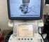 GE - Logiq E9 Ultrasound | Ultrasound Machine | EX4057