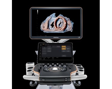 Mindray - Diagnostic Ultrasound System for Cardiovascular | Recho R9