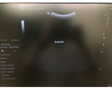 GE - 4C [Ultrasound Transducer] [EX2375]