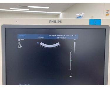 Philips - Ultrasound Machine | IU 22 Cart G.1