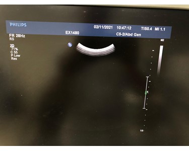 Philips - C5-2 Convex Transducer | EX2536