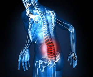 What is a Work Related Muscular Skeletal Disorder (WMSD)?