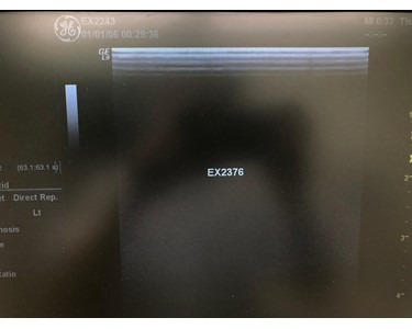 GE - M12L [Ultrasound Transducer] [EX2376]