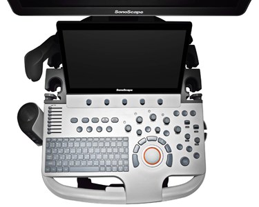 SonoScape - P50 Trolley Color Doppler Ultrasound System