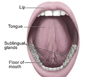 Certain mouth bacteria signal pancreatic cancer