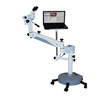 Gynaecology Colposcope