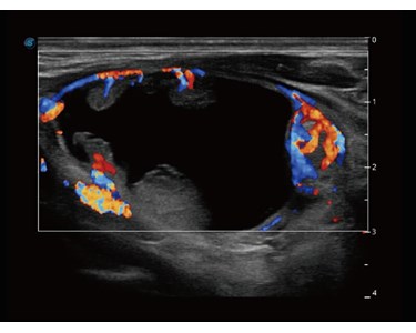 SonoScape - S60 Trolley Color Doppler Ultrasound System