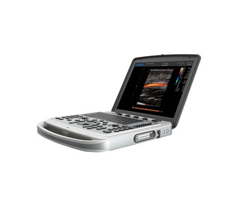 Portable Ultrasound Machine