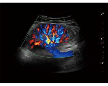 SonoScape - S9 Portable Color Doppler Ultrasound System