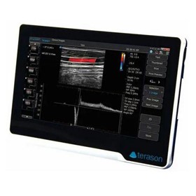 uSmart 3200T NexGen Colour Doppler Ultrasound Machine