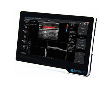 Terason - uSmart 3200T NexGen Colour Doppler Ultrasound Machine