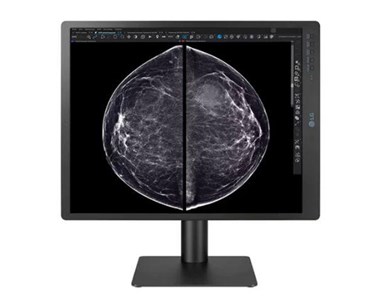 LG - 5MP 21″ Color Mammography 3D-Tomosynthesis Two-Monitor Display Setup