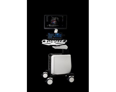 Vinno - Cart-Based Ultrasound | VINNO S300 