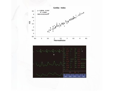 APS Technology Australia - Multi-parameter ICG Module – Non-invasive Hemodynamic Monitoring Syste