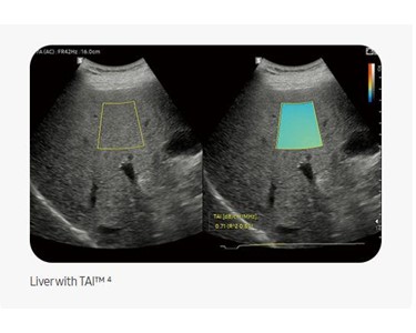 Samsung V6 Ultrasound for Animals