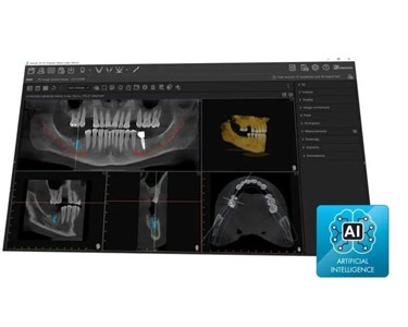 CBCT System | ProVecta 3D Prime