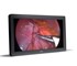Surgical Monitor | MDFC-8232 3xB