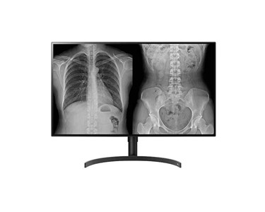 LG - Diagnostic Displays