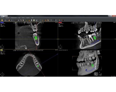 Owandy Radiology - CBCT/OPG/Ceph device | I-max PRO