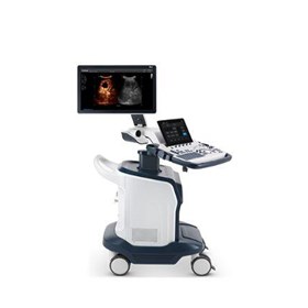 S60 Trolley Color Doppler Ultrasound System