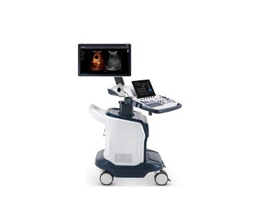 SonoScape - S60 Trolley Color Doppler Ultrasound System