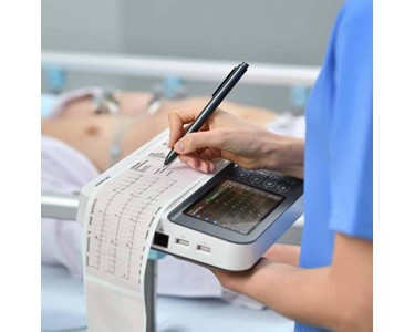 Mindray - Portable 12-Lead ECG Mindray BeneHeart R300