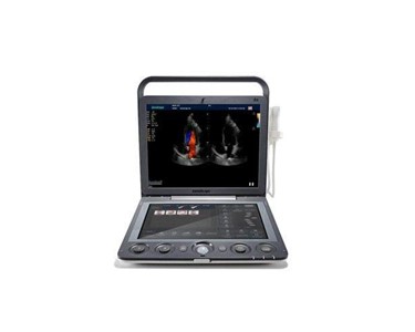 SonoScape - Portable Ultrasound System | S9