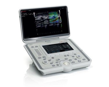 Esaote - Veterinary Ultrasound | MyLab™ OMEGA 