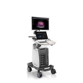 P60 Trolley Color Doppler Ultrasound System