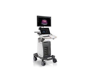 SonoScape - P60 Trolley Color Doppler Ultrasound System