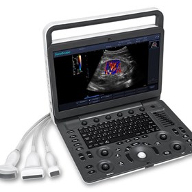 E3 Portable Color Doppler Ultrasound System