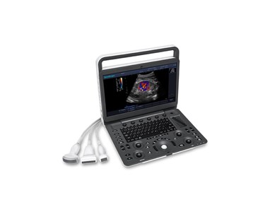 SonoScape - E3 Portable Color Doppler Ultrasound System
