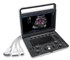 SonoScape - E3 Portable Color Doppler Ultrasound System